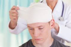 Important Things to know about Concussions
